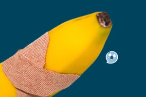 penyebab bekas sunat bengkak